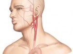 Figure 1 : Anatomie de la carotide