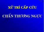 ctnguc1