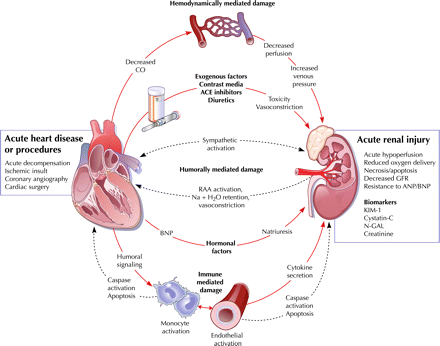 Cardiorenal_syndrome_pathophysiology_2_Mbah_Dukun_Bagong