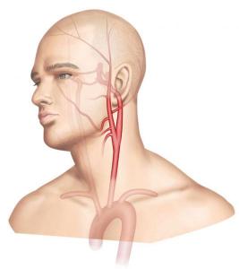 Figure 1 : Anatomie de la carotide