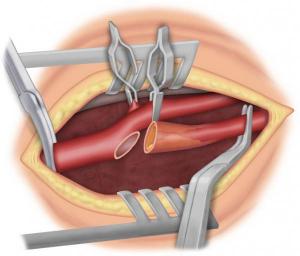 Figure 6a