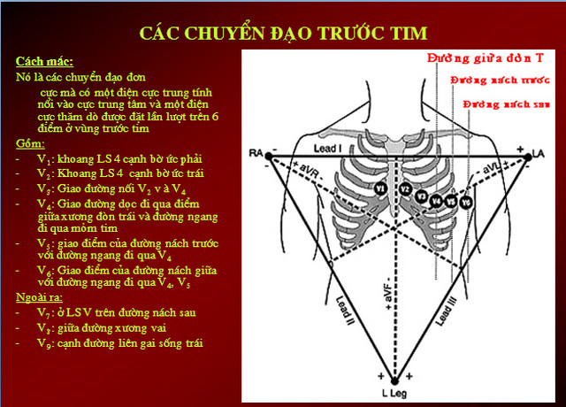 ecg2