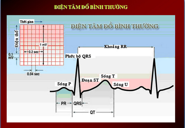 ecg3