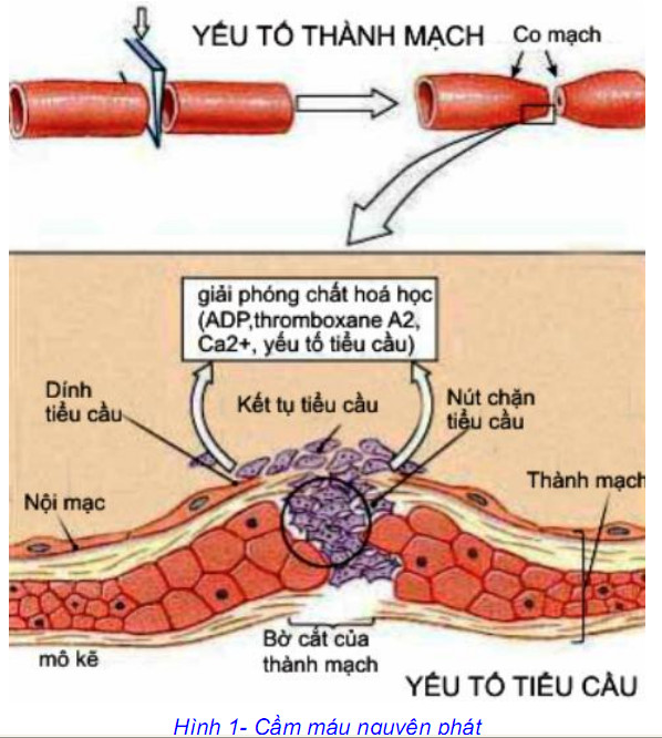 dm1